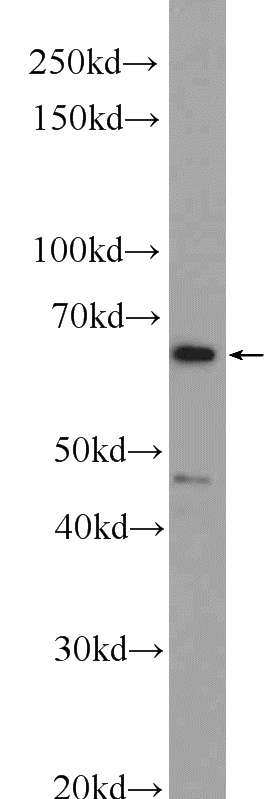 HepG2 cells were subjected to SDS PAGE followed by western blot with Catalog No:114369(PSIP1 Antibody) at dilution of 1:1000