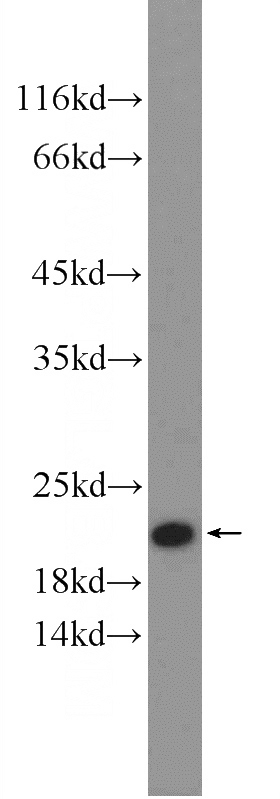 mouse liver tissue were subjected to SDS PAGE followed by western blot with Catalog No:115589(SRI Antibody) at dilution of 1:600