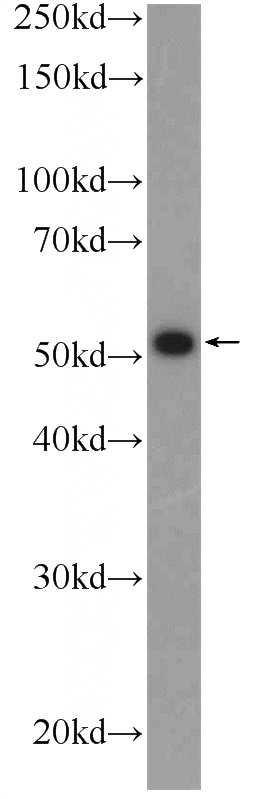 mouse brain tissue were subjected to SDS PAGE followed by western blot with Catalog No:116960(ZNF215 Antibody) at dilution of 1:300