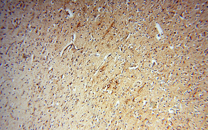 Immunohistochemical of paraffin-embedded human brain using Catalog No:113076(NDUFB7 antibody) at dilution of 1:100 (under 10x lens)
