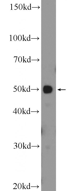 HepG2 cells were subjected to SDS PAGE followed by western blot with Catalog No:108140(API5 Antibody) at dilution of 1:300