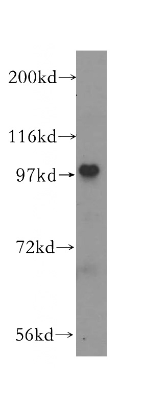 HeLa cells were subjected to SDS PAGE followed by western blot with Catalog No:114858(RTF1 antibody) at dilution of 1:300