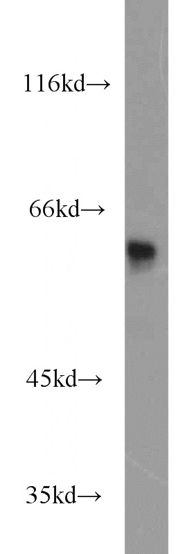 Jurkat cells were subjected to SDS PAGE followed by western blot with Catalog No:112115(KPNA5 antibody) at dilution of 1:2000