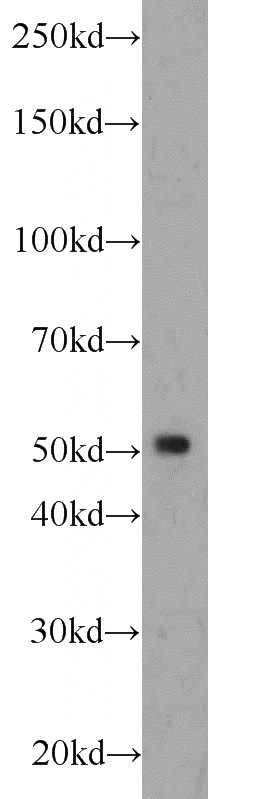 L02 cells were subjected to SDS PAGE followed by western blot with Catalog No:115232(SIL1 antibody) at dilution of 1:1500