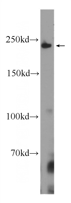 HeLa cells were subjected to SDS PAGE followed by western blot with Catalog No:107592(MYH11 Antibody) at dilution of 1:1000
