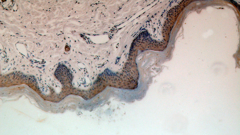 Immunohistochemical of paraffin-embedded human skin using Catalog No:114930(RRP8 antibody) at dilution of 1:100 (under 10x lens)