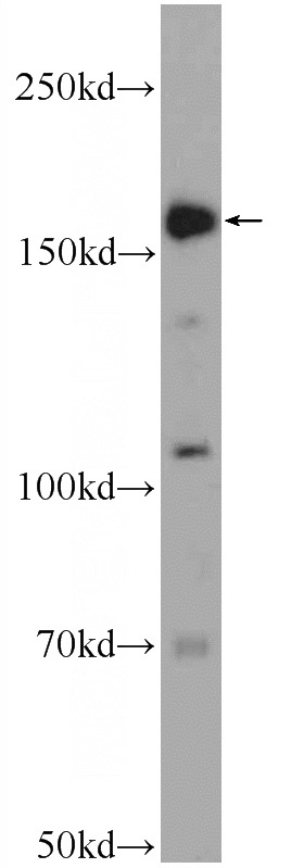 HeLa cells were subjected to SDS PAGE followed by western blot with Catalog No:113902(PIK3C2B Antibody) at dilution of 1:600