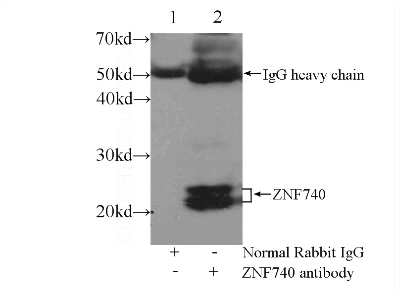 IP Result of anti-ZNF740 (IP:Catalog No:117028, 3ug; Detection:Catalog No:117028 1:600) with mouse brain tissue lysate 4000ug.