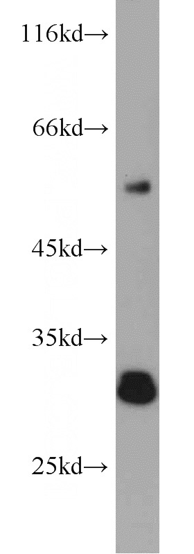 mouse liver tissue were subjected to SDS PAGE followed by western blot with Catalog No:107911(AFMID antibody) at dilution of 1:500