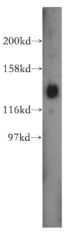 HeLa cells were subjected to SDS PAGE followed by western blot with Catalog No:113713(PER3 antibody) at dilution of 1:400