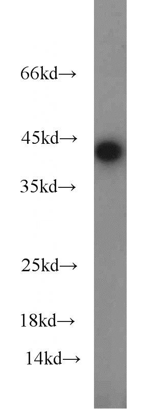 mouse liver tissue were subjected to SDS PAGE followed by western blot with Catalog No:113425(ORM1 antibody) at dilution of 1:1000