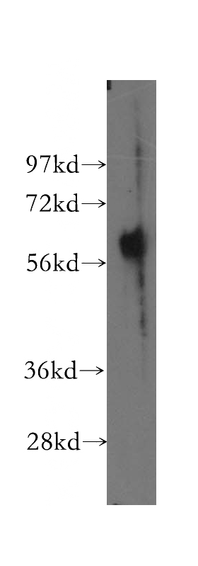 human lung tissue were subjected to SDS PAGE followed by western blot with Catalog No:110376(ESAM antibody) at dilution of 1:500