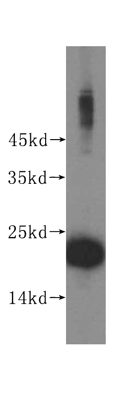 Jurkat cells were subjected to SDS PAGE followed by western blot with Catalog No:114880(RPL24 antibody) at dilution of 1:500