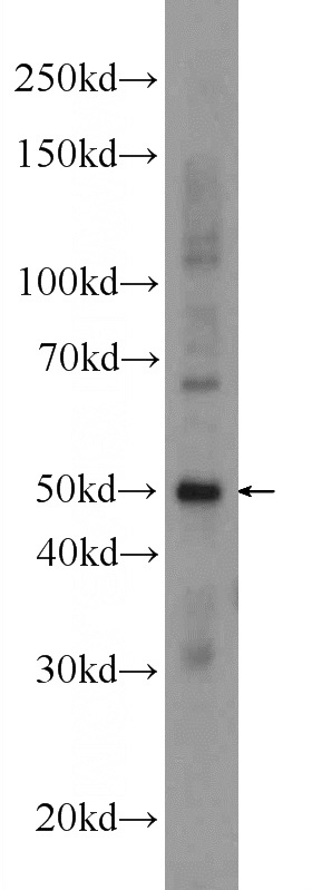 mouse brain tissue were subjected to SDS PAGE followed by western blot with Catalog No:110829(GAL3ST3 Antibody) at dilution of 1:600
