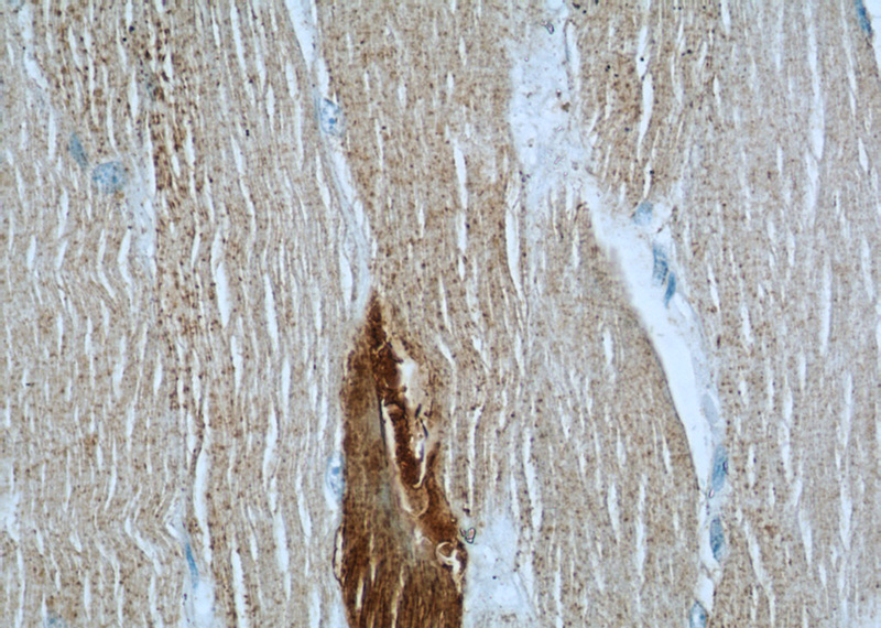 Immunohistochemical of paraffin-embedded human skeletal muscle using Catalog No:115625(ST3GAL5 antibody) at dilution of 1:50 (under 40x lens)