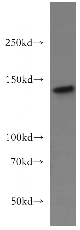 Jurkat cells were subjected to SDS PAGE followed by western blot with Catalog No:111843(INPP5D antibody) at dilution of 1:300
