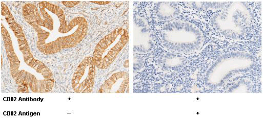 CD82 / KAI-1 Antibody, Rabbit PAb, Antigen Affinity Purified, Immunohistochemistry