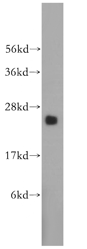 HeLa cells were subjected to SDS PAGE followed by western blot with Catalog No:114301(GINS2 antibody) at dilution of 1:500