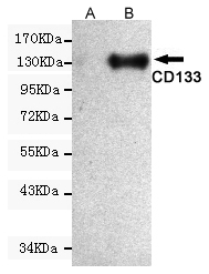 Western blot detection of CD133 expression in CHO-k1 cells non-transfected (A) or transfected (B) with CD133 and using CD133 mouse mAb (1:1000 diluted).Predicted band size:97KDa.Observed band size:133KDa.
