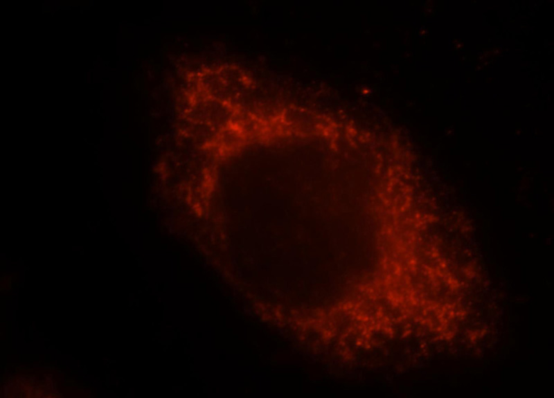 Immunofluorescent analysis of Hela cells, using ALDH3A2 antibody Catalog No:107968 at 1:25 dilution and Rhodamine-labeled goat anti-rabbit IgG (red).