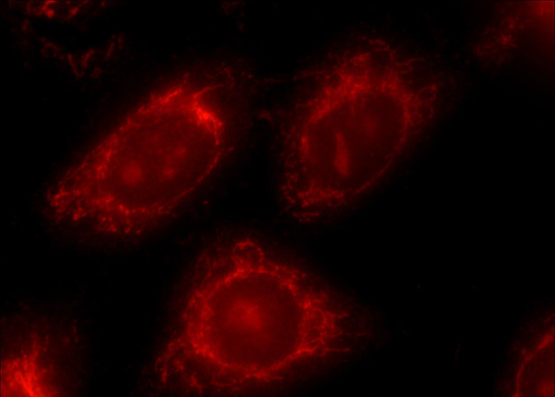 Immunofluorescent analysis of HeLa cells using Catalog No:108286(ATF6 Antibody) at dilution of 1:25 and Rhodamine-Goat anti-Rabbit IgG