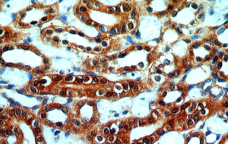 Immunohistochemical of paraffin-embedded human kidney using Catalog No:110592(FAM49B antibody) at dilution of 1:100 (under 40x lens)