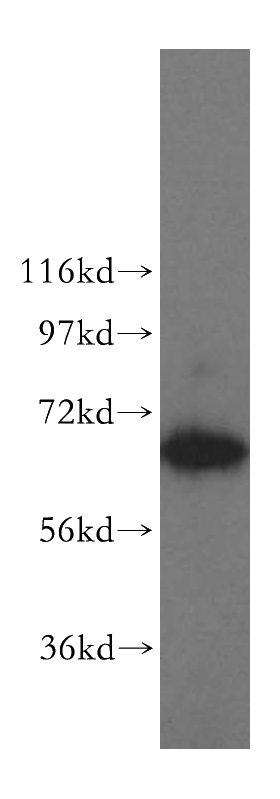 HepG2 cells were subjected to SDS PAGE followed by western blot with Catalog No:115885(TBRG4 antibody) at dilution of 1:500