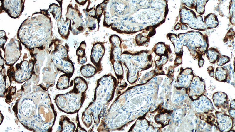 Immunohistochemistry of paraffin-embedded human placenta tissue slide using Catalog No:113933(CSH2 Antibody) at dilution of 1:50 (under 10x lens)