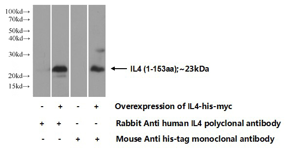 Transfected HEK-293 cells were subjected to SDS PAGE followed by western blot with Catalog No:111745(IL4 Antibody) at dilution of 1:700