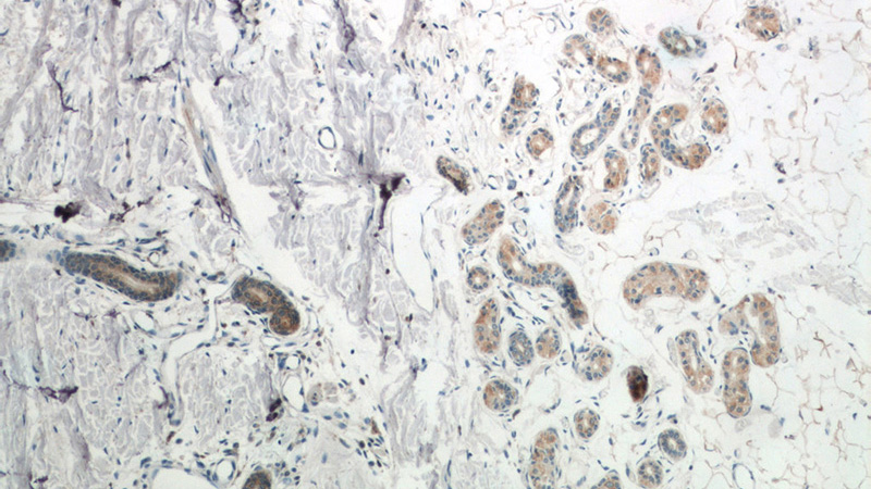 Immunohistochemistry of paraffin-embedded human skin tissue slide using Catalog No:116031(TGM5 Antibody) at dilution of 1:50 (under 10x lens)