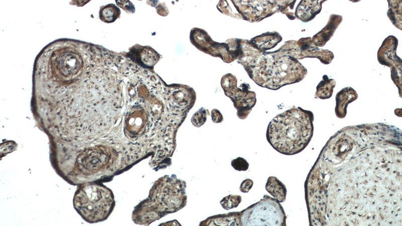 Immunohistochemistry of paraffin-embedded human placenta tissue slide using Catalog No:108011(PRKAG2 Antibody) at dilution of 1:50 (under 10x lens)
