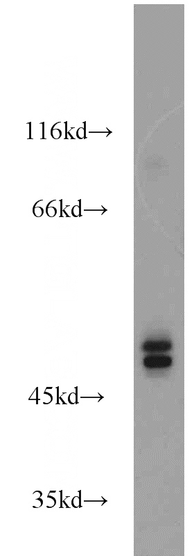 Jurkat cells were subjected to SDS PAGE followed by western blot with Catalog No:117241(POU3F2 antibody) at dilution of 1:1200