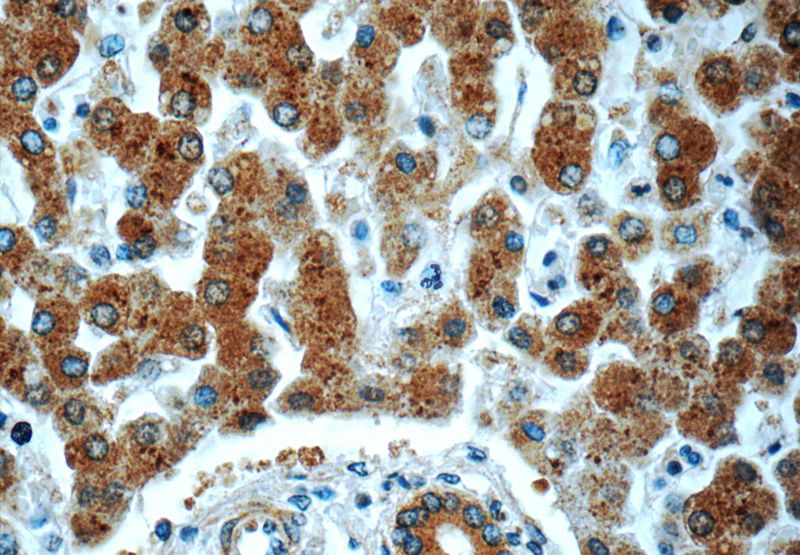 Immunohistochemistry of paraffin-embedded human liver tissue slide using Catalog No:115573(SPINK9 Antibody) at dilution of 1:50 (under 40x lens)