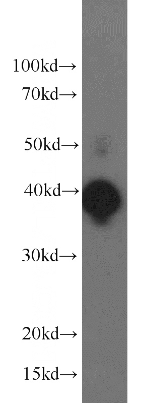 HeLa cells were subjected to SDS PAGE followed by western blot with Catalog No:110362(ERK1/2 antibody) at dilution of 1:3000