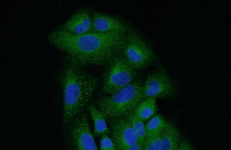 Immunofluorescent analysis of (10% Formaldehyde) fixed A549 cells using Catalog No:116392(TFG Antibody) at dilution of 1:50 and Alexa Fluor 488-congugated AffiniPure Goat Anti-Rabbit IgG(H+L)