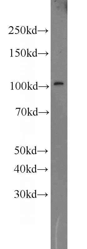 mouse eye tissue were subjected to SDS PAGE followed by western blot with Catalog No:114803(RPGR antibody) at dilution of 1:500