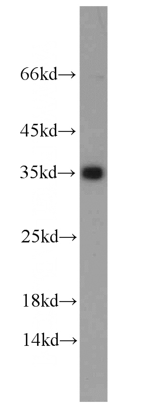 HeLa cells were subjected to SDS PAGE followed by western blot with Catalog No:110237(EMD antibody) at dilution of 1:1000