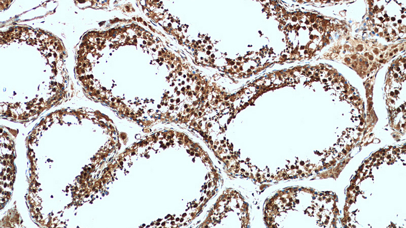 Immunohistochemical of paraffin-embedded human testis using Catalog No:108652(C13orf18 antibody) at dilution of 1:50 (under 10x lens)