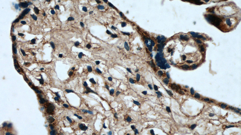 Immunohistochemical of paraffin-embedded human placenta using Catalog No:114082(PPARG antibody) at dilution of 1:50 (under 40x lens)