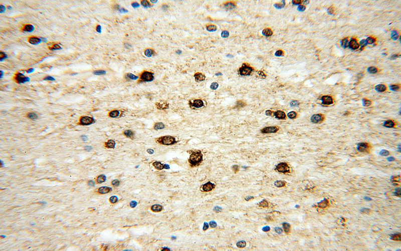 Immunohistochemical of paraffin-embedded human brain using Catalog No:111584(ICA1L antibody) at dilution of 1:50 (under 40x lens)