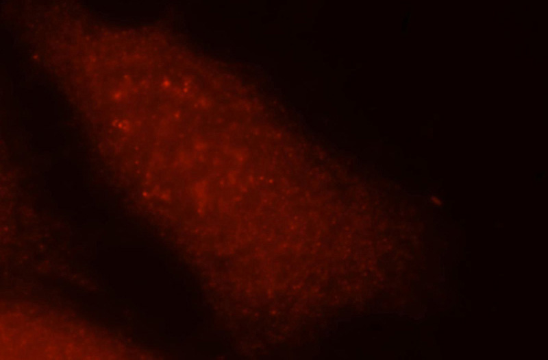 Immunofluorescent analysis of Hela cells, using GMPPA antibody Catalog No:111101 at 1:25 dilution and Rhodamine-labeled goat anti-rabbit IgG (red).