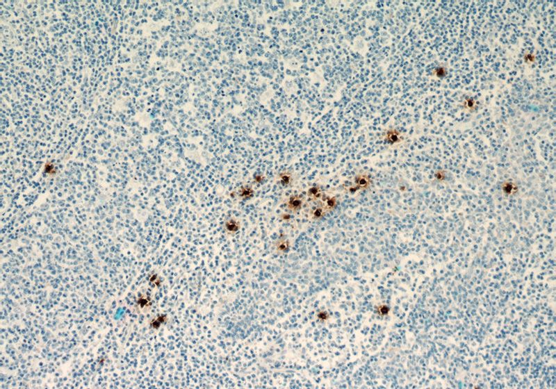 Immunohistochemistry of paraffin-embedded human tonsillitis tissue slide using (TPSAB1 Antibody) at dilution of 1:5000(under 10x lens). Heat mediated antigen retrieved with Citric acid buffer, pH6.0