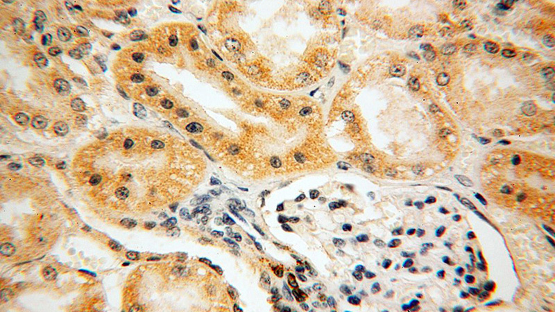 Immunohistochemical of paraffin-embedded human kidney using Catalog No:114286(Prx5 antibody) at dilution of 1:50 (under 40x lens)