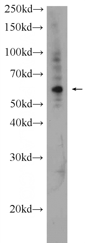 mouse thymus tissue were subjected to SDS PAGE followed by western blot with Catalog No:113322(ODC1 Antibody) at dilution of 1:300