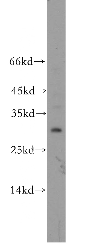 mouse liver tissue were subjected to SDS PAGE followed by western blot with Catalog No:111438(HOXD12 antibody) at dilution of 1:200