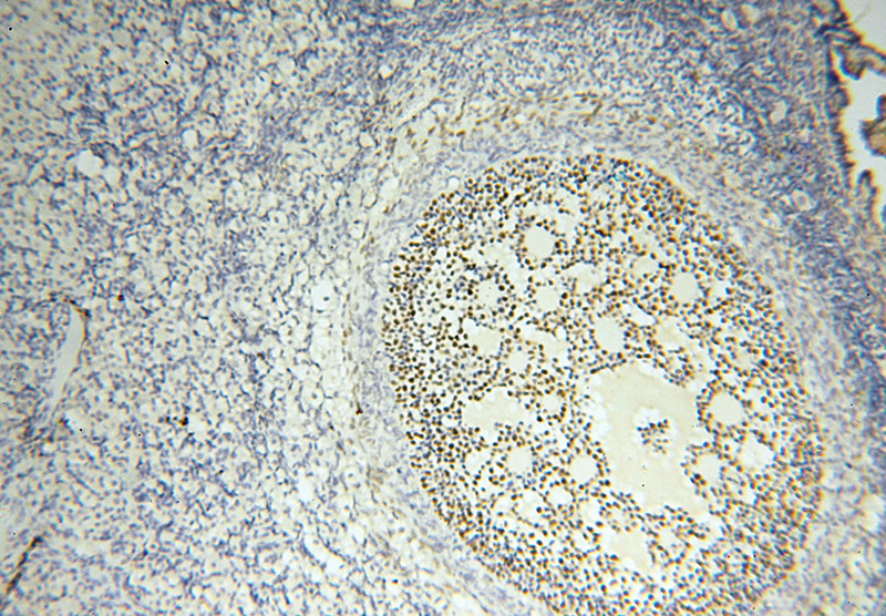 Immunohistochemical of paraffin-embedded human ovary using Catalog No:110712(FOXP4 antibody) at dilution of 1:100 (under 10x lens)
