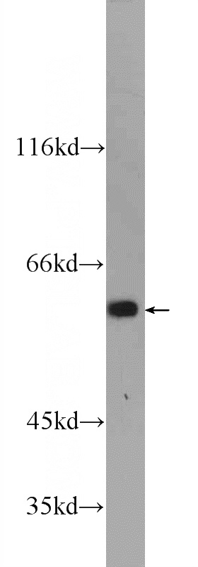 mouse embryo tissue were subjected to SDS PAGE followed by western blot with Catalog No:112103(KLHL31 Antibody) at dilution of 1:1000