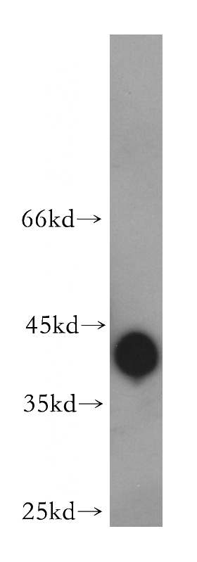 mouse testis tissue were subjected to SDS PAGE followed by western blot with Catalog No:108372(BBS5 antibody) at dilution of 1:400
