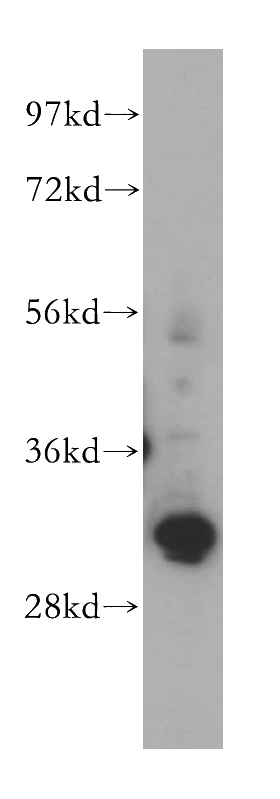 K-562 cells were subjected to SDS PAGE followed by western blot with Catalog No:111231(GTF2F2 antibody) at dilution of 1:500