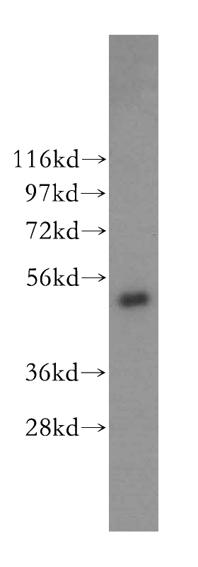 MCF7 cells were subjected to SDS PAGE followed by western blot with Catalog No:109814(KRT8 antibody) at dilution of 1:300